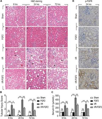 Fibroblast Growth Factor 2 Attenuates Renal Ischemia-Reperfusion Injury via Inhibition of Endoplasmic Reticulum Stress